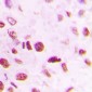 Anti-SMAD6 Antibody
